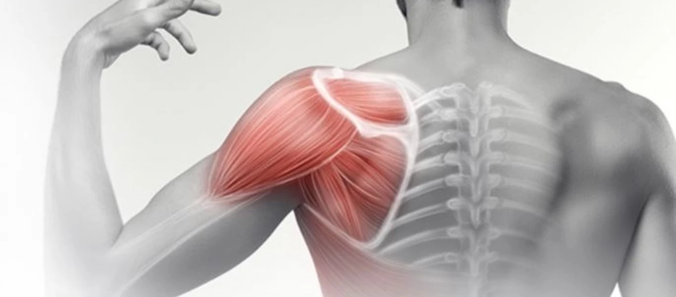 Τενοντίτιδα ώμου: Πώς εκδηλώνεται και τι να κάνετε για την αντιμετωπίσετε